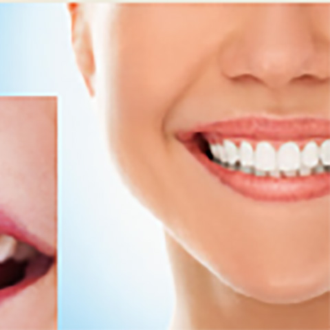 ボトックス治療