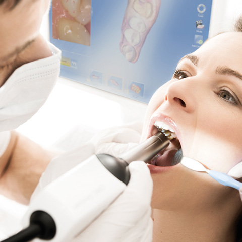 セレックの特徴