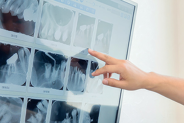 カウンセリングコーナー