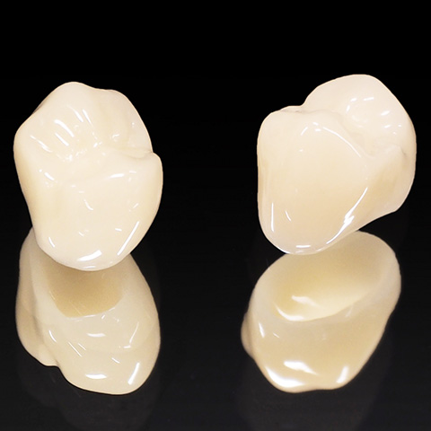 ジルコニアセラミック治療